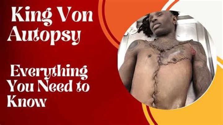 King Von Autopsy: Cause of Death Explained