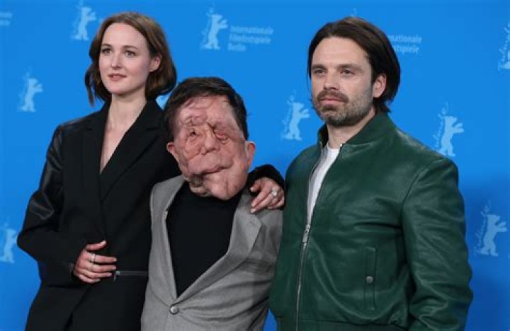 Understanding Adam Pearson's Relationships: A Journey Through His Life